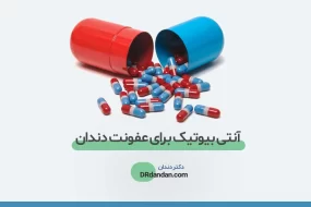 قرص برای عفونت دندان