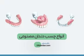 انواع چسب دندان مصنوعی