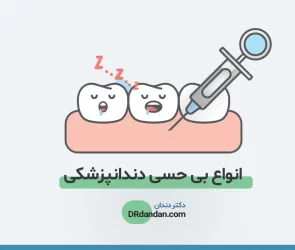بیحسی دندانپزشکی