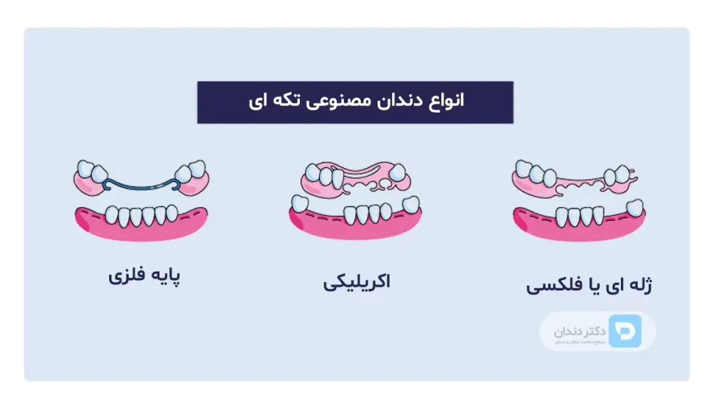 عکس انواع دندان مصنوعی تکه ای
