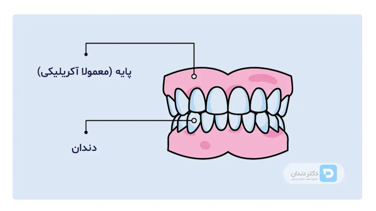تصویر شماتیک دندان مصنوعی کامل معمولی