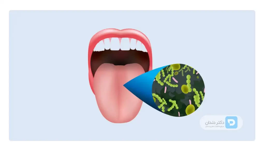 عکس شماتیک داخل دهان و باکتری هایی که در دهان وجود دارد