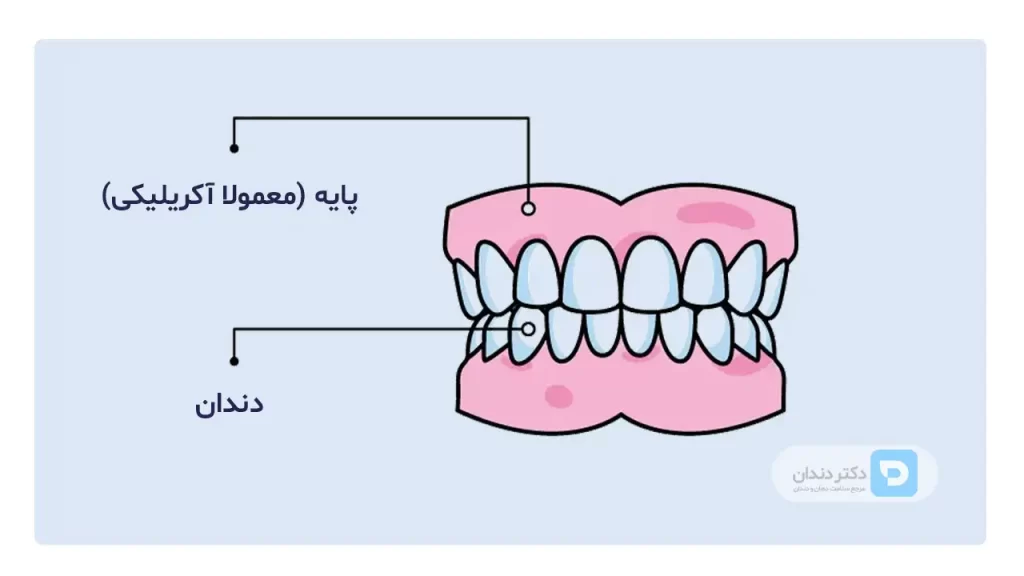 عکس بخش های مختلف دندان مصنوعی کامل یا دست دندان
