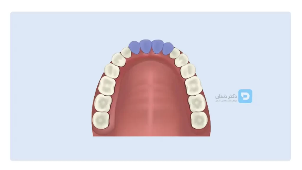 عکس دندان های ثنایا یا پیش در فک بالا یا پایین