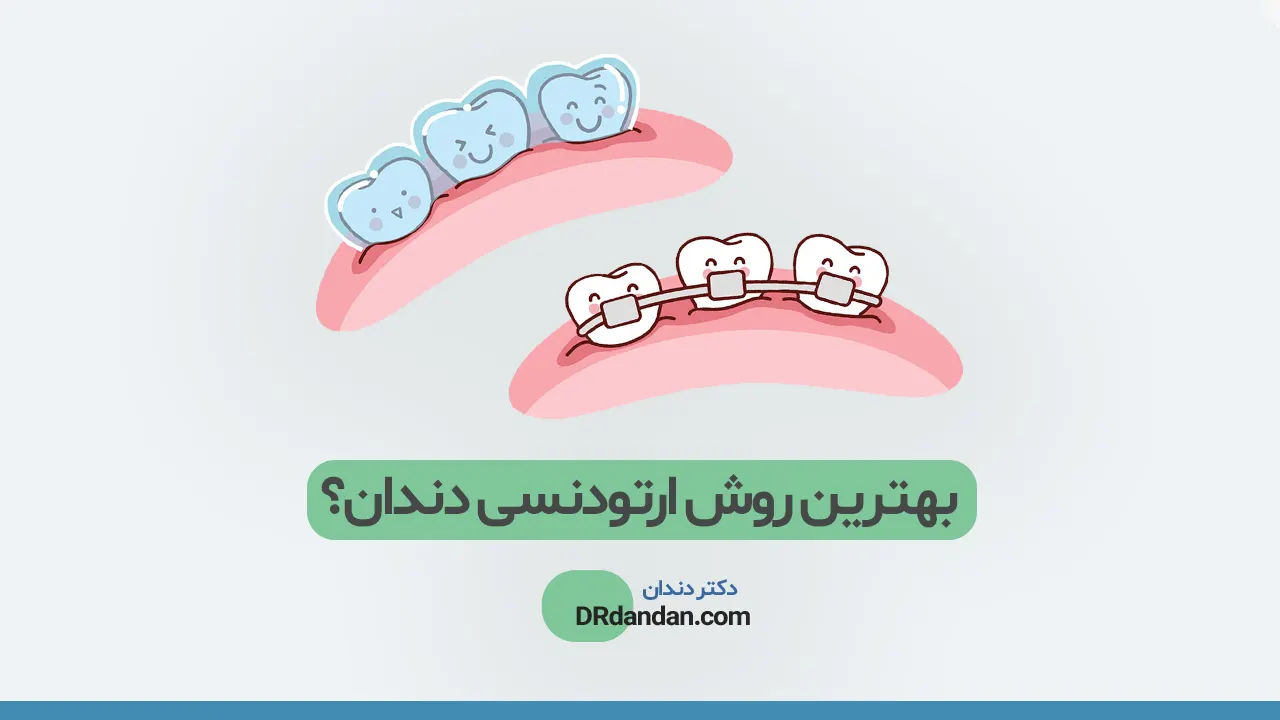 عکس بهترین روش ارتودنسی دندان