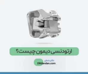 عکس ارتودنسی دیمون