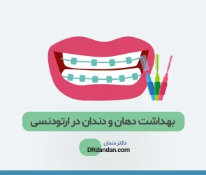 بهداشت دهان و دندان در ارتودنسی